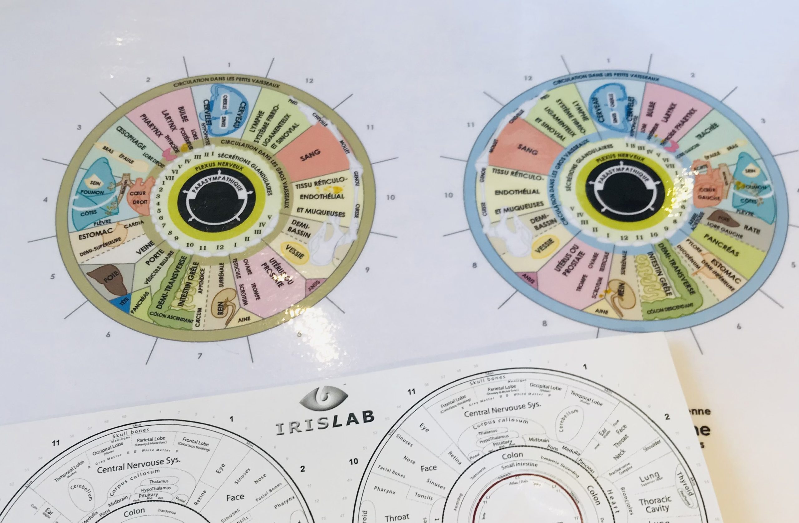 cartographie iris iridologie