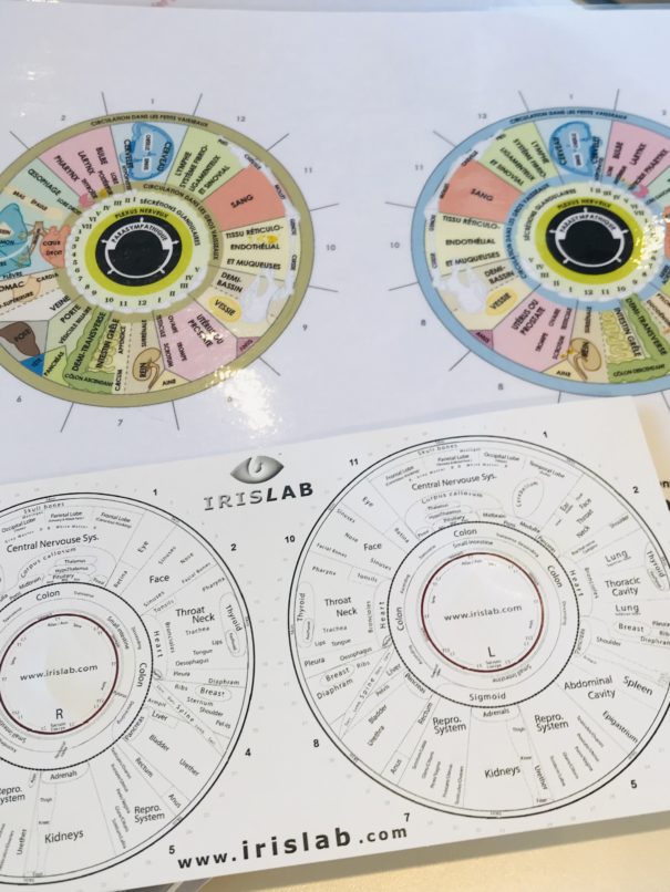 Bilan de votre iris, naturopathe Aix-en-Provence